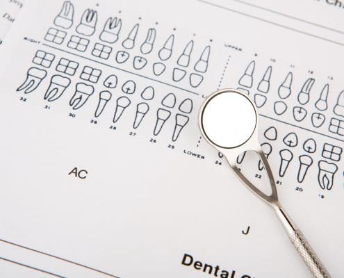 dental-tools-and-equipment-on-dental-chart