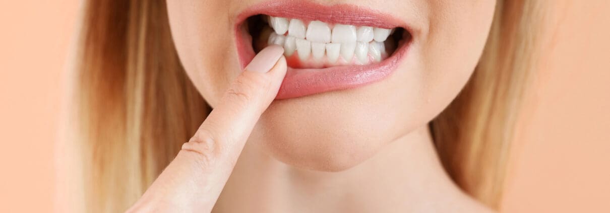 Gum disease: symptoms, causes, and treatment options