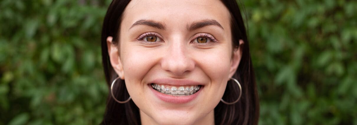 Orthodontics: braces, aligners, and other options for a straighter smile